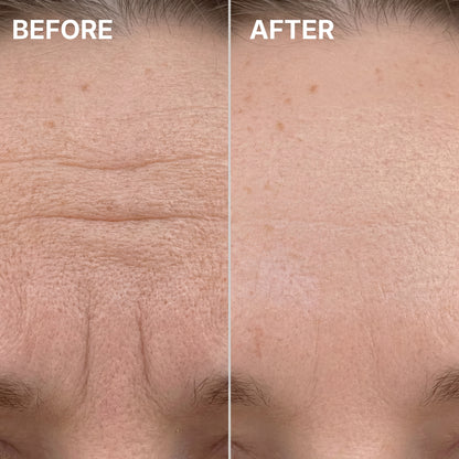 PDRN Pink Collagen Volume Multi Balm